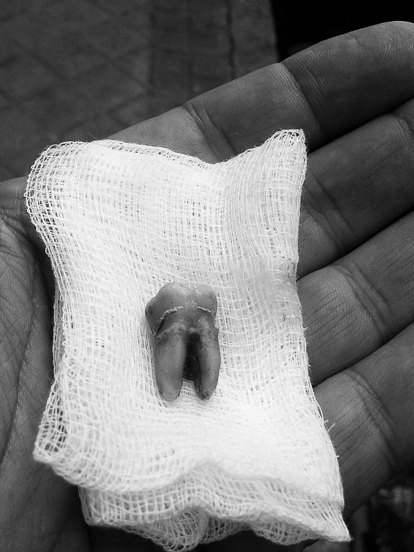 An open hand holding a tooth wrapped in gauze.